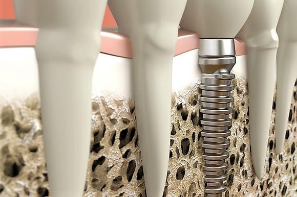 how wettability affects biocompatibility