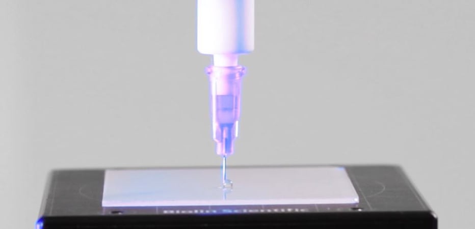 Automated Dynamic Contact Angle Measurement With the Needle Method