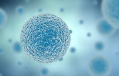 How to Characterize Lipid-Based Systems with QCM-D