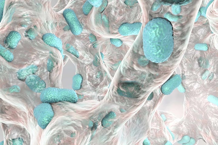 Biofouling and biofilm assessment